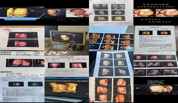 怀孕6个月四维彩超视频 - 汕头怀孕六个月四维彩超照片真实